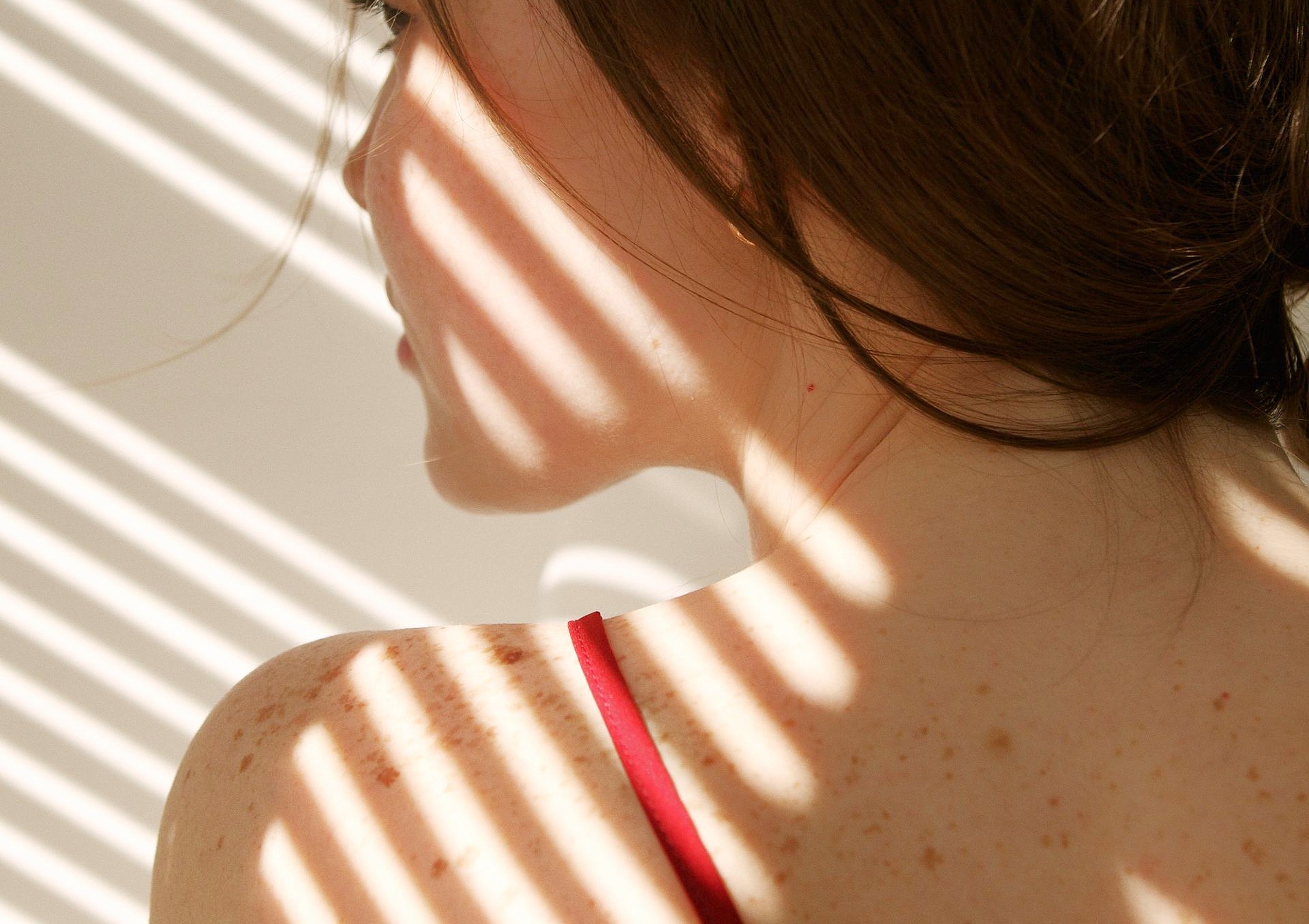 What Causes Pigmentation/Uneven Skin Tone and How to Improve Its Appearance?